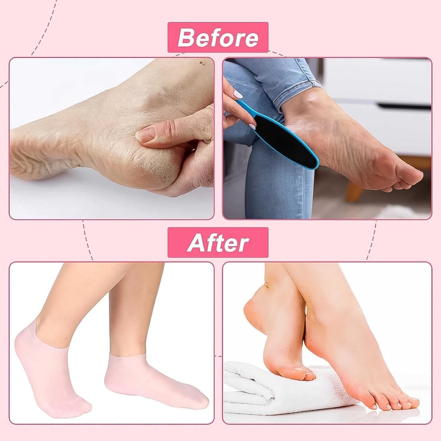 Silicone Moisturizing Socks (1 Pair)